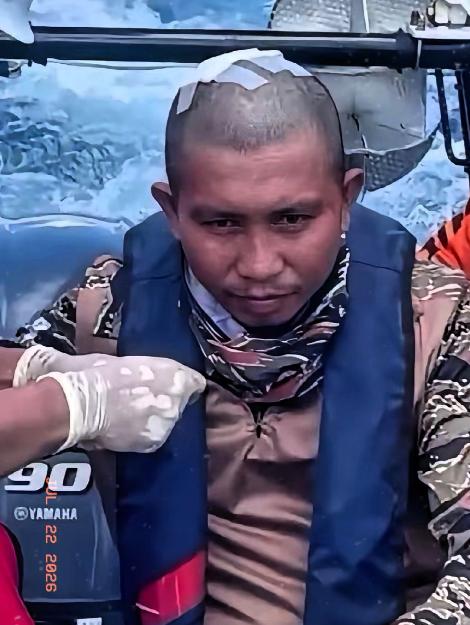 这位就是在仁爱礁冲突中受伤的菲律宾军人，成“英雄”了？真正值得警惕的，不是伤口，