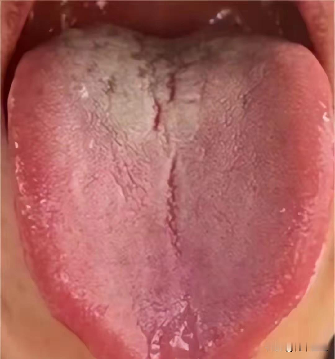 朋友，看看你的舌头，已经红成什么样子， 非得等到补不进去才行吗

主诉：欲望强，