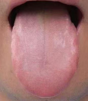肾精亏虚、气血不足，是男性早衰各类不适的核心根源








前段时间，有位