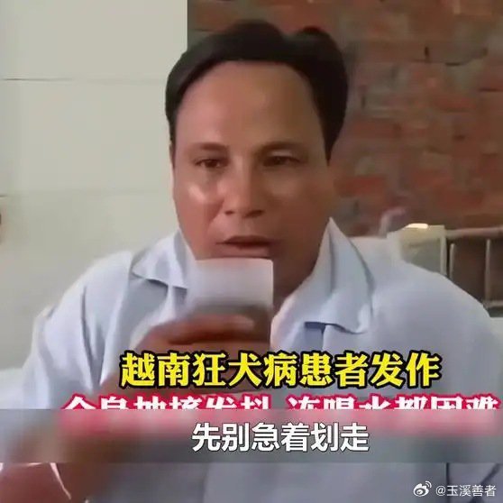有报道：有人被狗咬了，没打疫苗，十几年后复发死了。《狂犬病发作时为何怕水》播放量