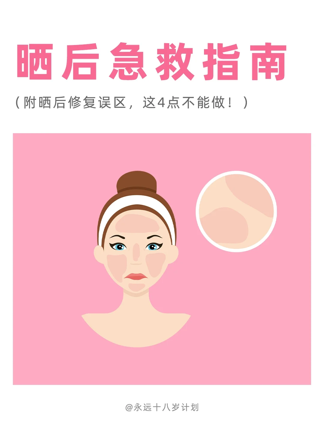 永远十八岁  晒后急救指南