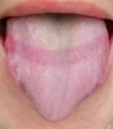 改善机体过度敏感，中医核心调理思路全解析






很多男同胞最大的困扰就是精