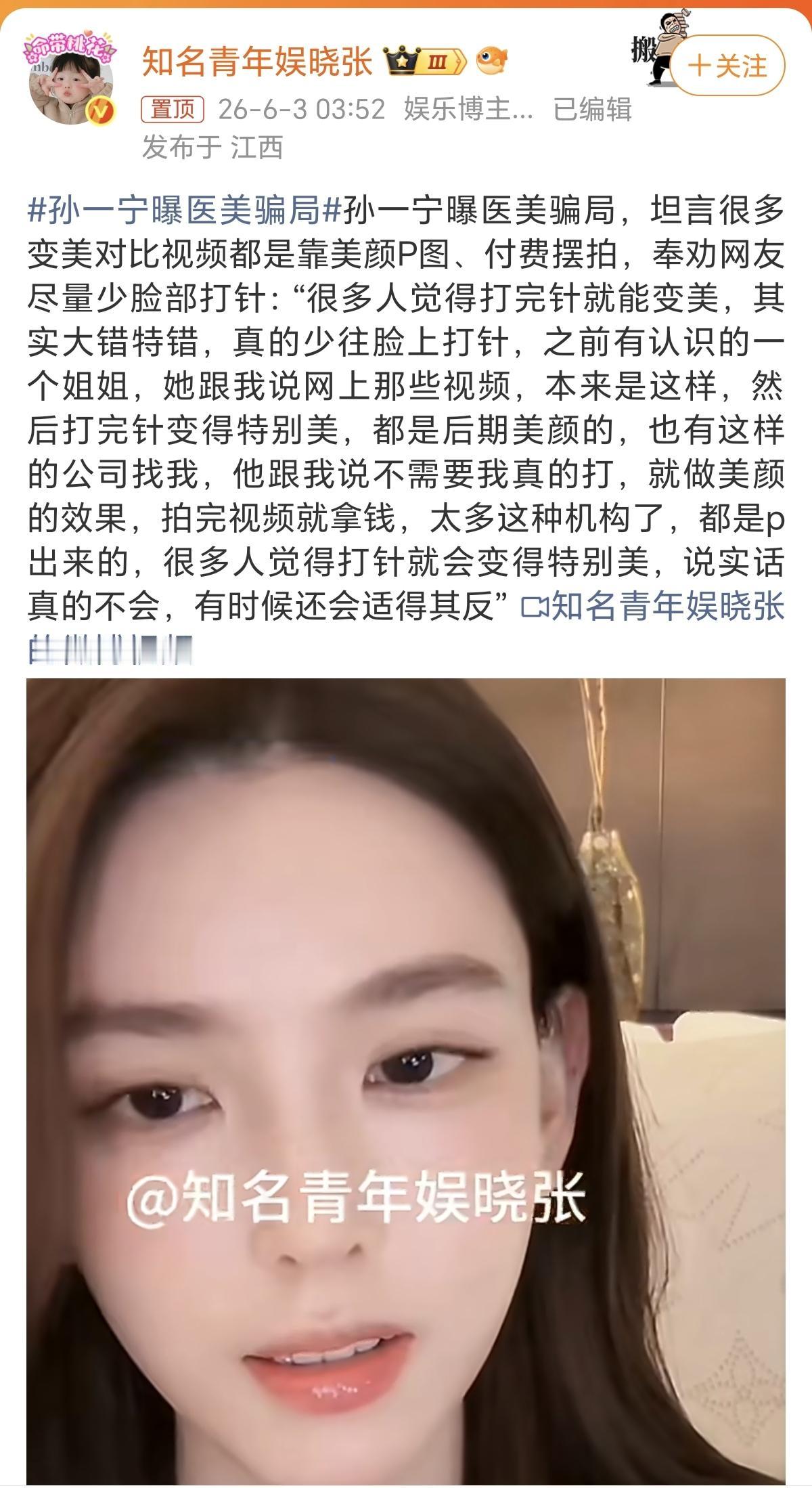 总算有人说大实话了。
有时候我真不理解现在的女孩子，
明明已经长得很美了，还是有