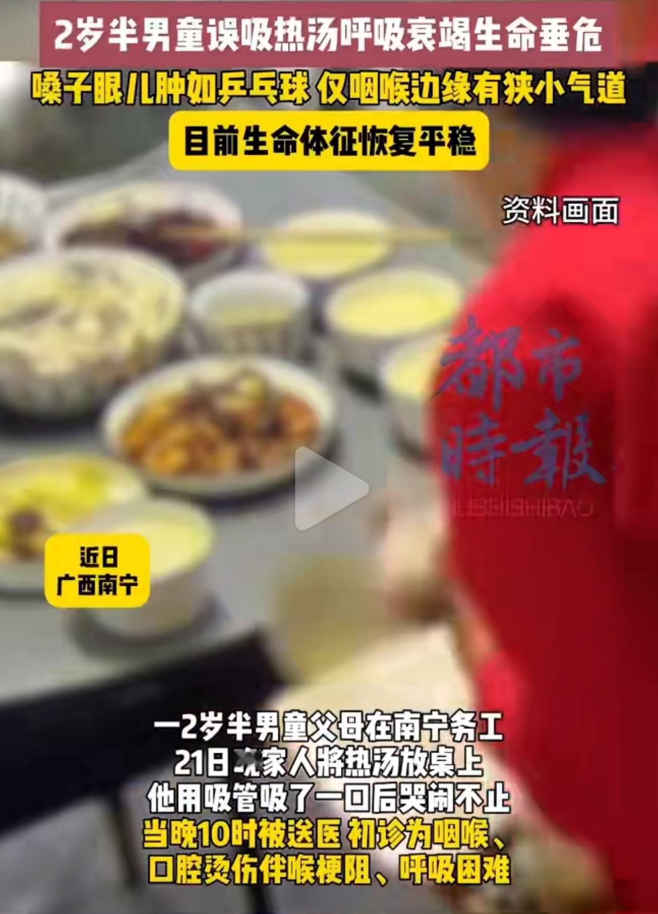 一口热汤把2岁娃送进ICU！只是用吸管吸了口80℃的热汤，2岁娃瞬间脸憋得发紫—