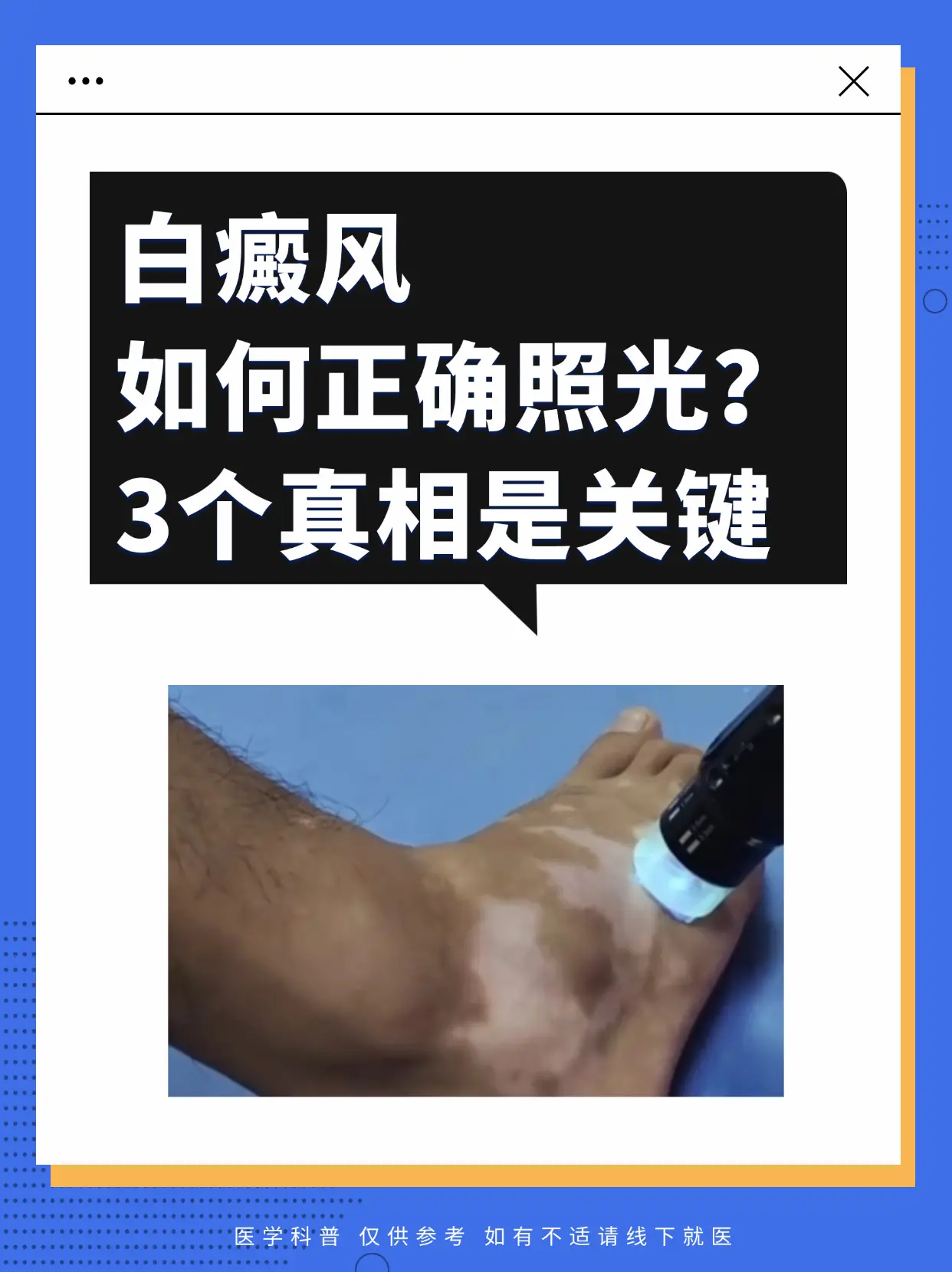 医学科普 白癜风 白癜风科普 白斑 硬核健康科普行动