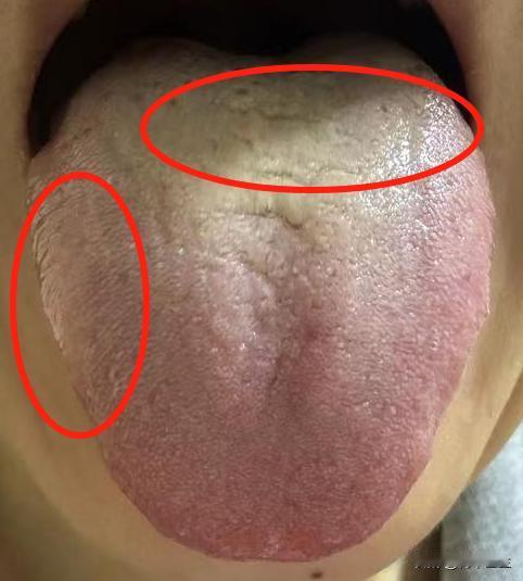 姑娘，你这真是人傻钱多，这么好的补药，被你全浪费了

后台有个粉丝联系我说：我这