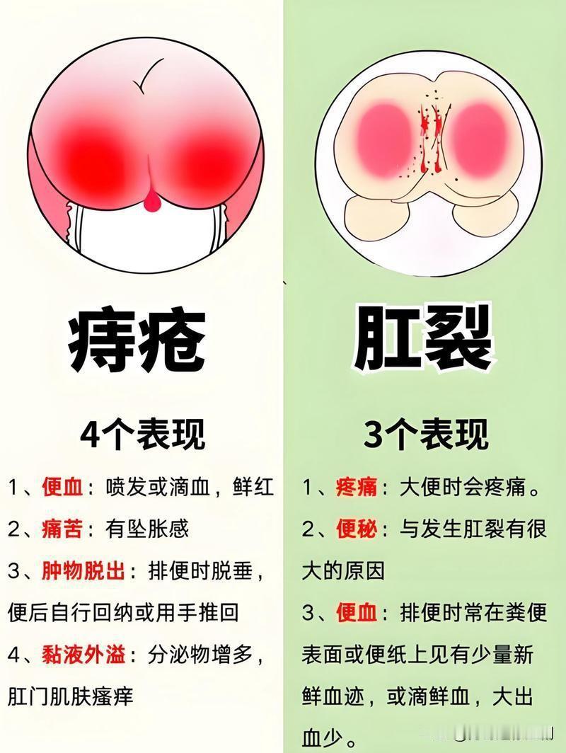 痔疮加肛裂大家都是怎么解决的呢痔疮合并肛裂是典型的“痛+血”组合，解决思路必须先