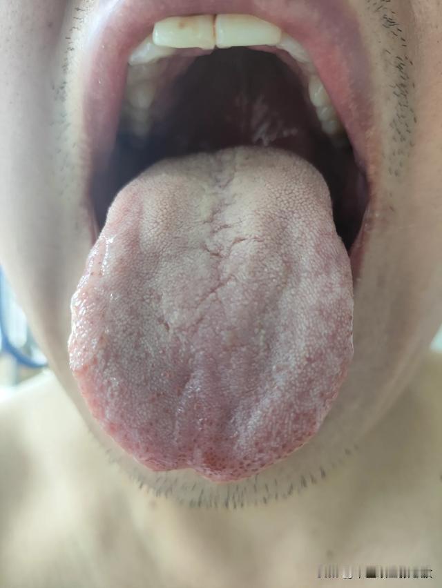才32岁坚持不到3分钟，都这样了，你还不好意思来门诊[what][what][w