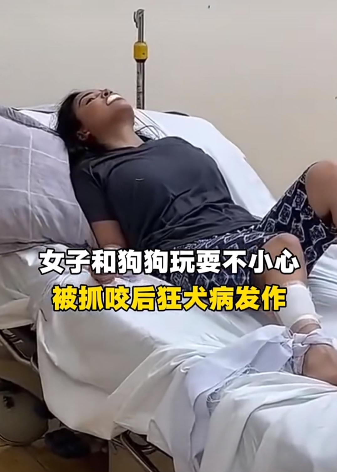 真不能大意!
长沙中年女子被自己幼犬咬破手指，没当回事，结果两个月后引发狂犬病