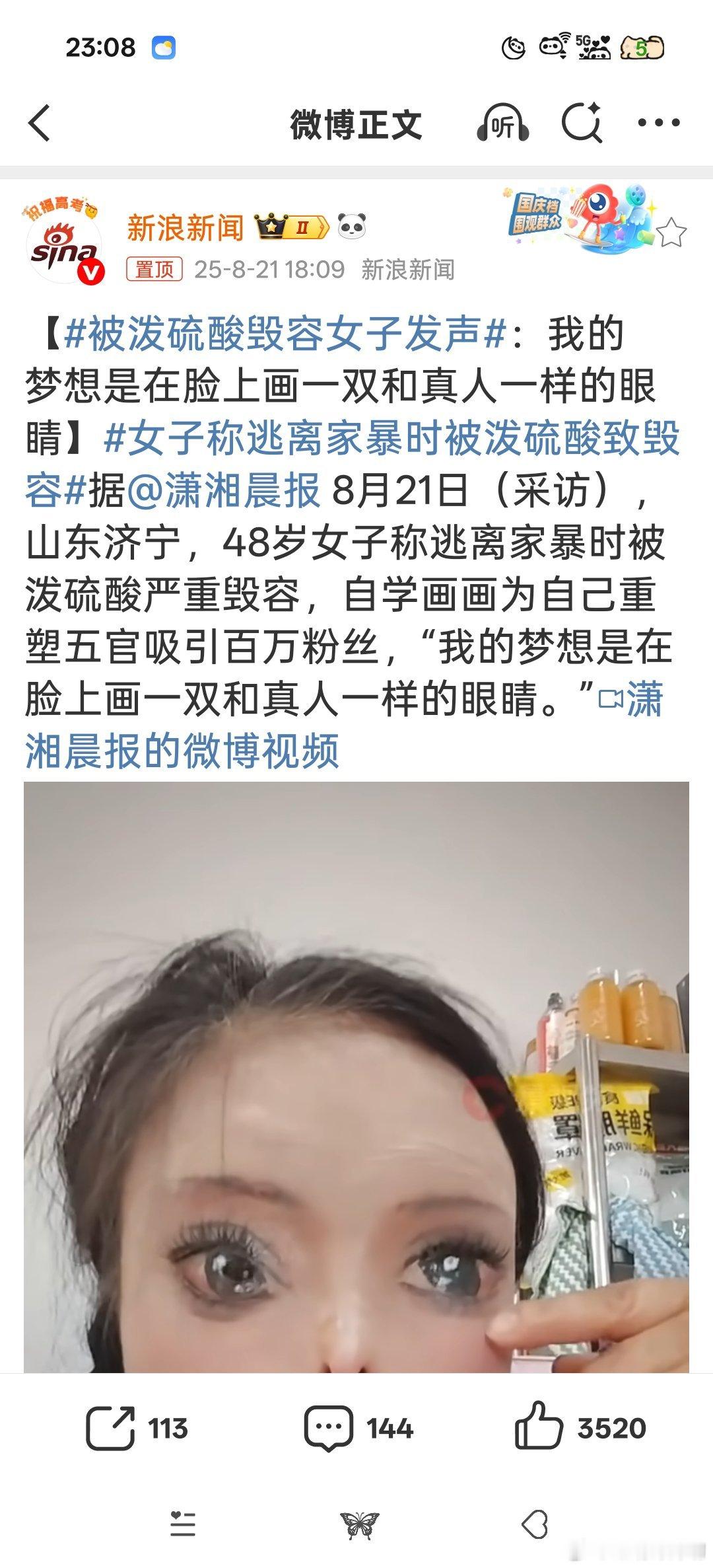 被泼硫酸毁容女子发声家暴男这辈子下辈子下下辈子都不得好死！！！！！！这位女性很坚