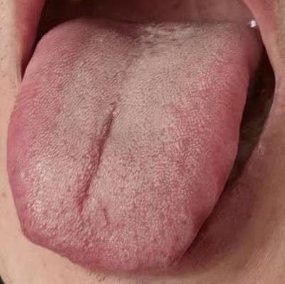 男性状态偏弱，温阳通络才是正确思路






同时出现出现宗筋敏感而弱是男同胞