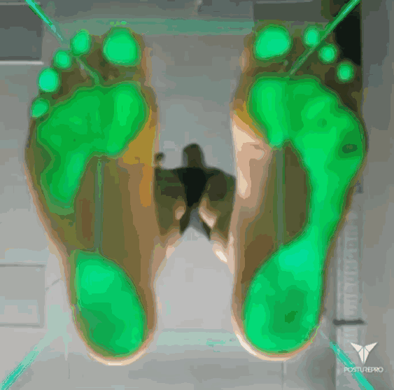 #足底筋膜炎#  昨天讲了脚，今天来换个视角来看你的jio🦶🏻👉非常有代表