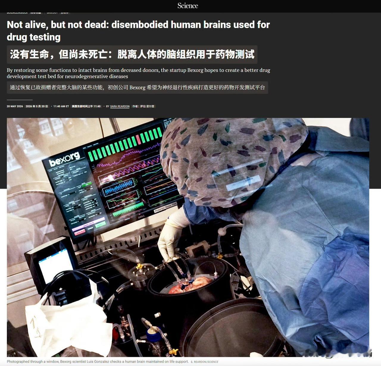 一个美国医药公司，掏了700多个人的脑子，体外循环维持活性，然后试验药物。Bex