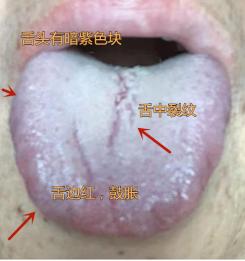 一直闲不住的人，但是就知道各种忙，疏于管理自己的身体，50岁的人把身体照顾的跟8