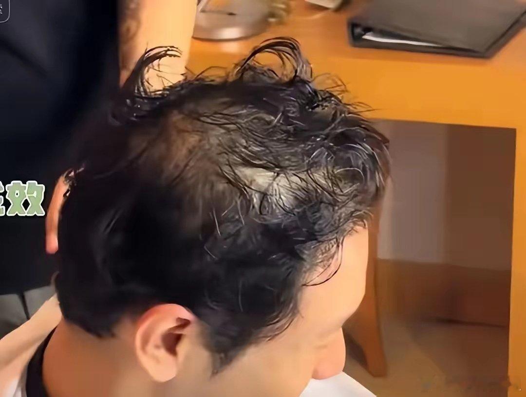 黄晓明的头发稀疏又有白发了！ ​​​