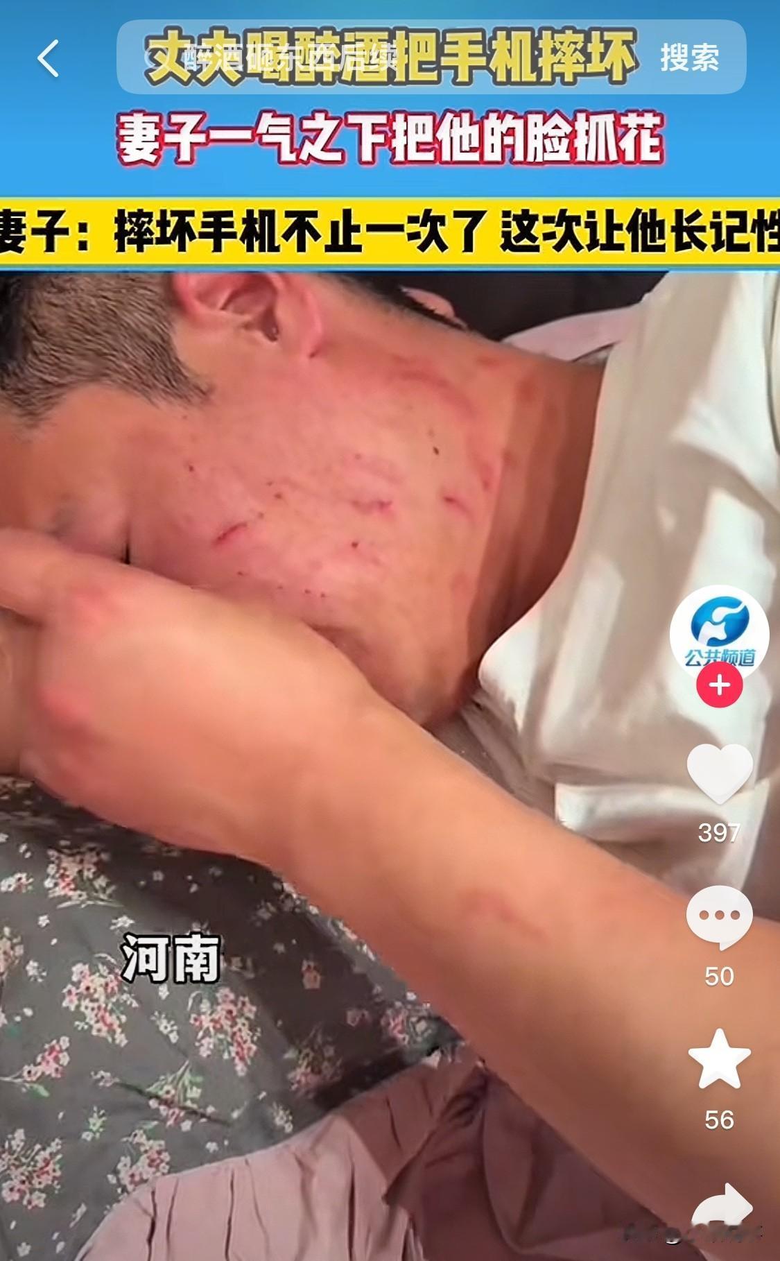 丈夫出去喝醉了把手机摔坏，
回到家被妻子发现后，
妻子气不打一处，直接把丈夫的脸