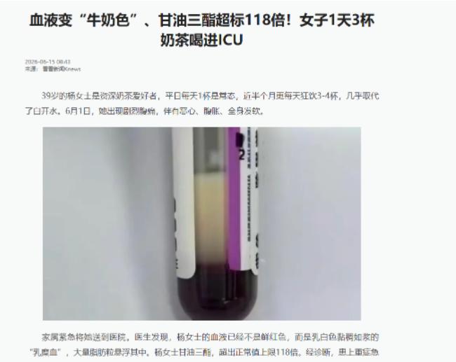 一管抽出来的血，不是红色的。
杨女士，39岁，送进急诊的时候，医生拿到她的血样—