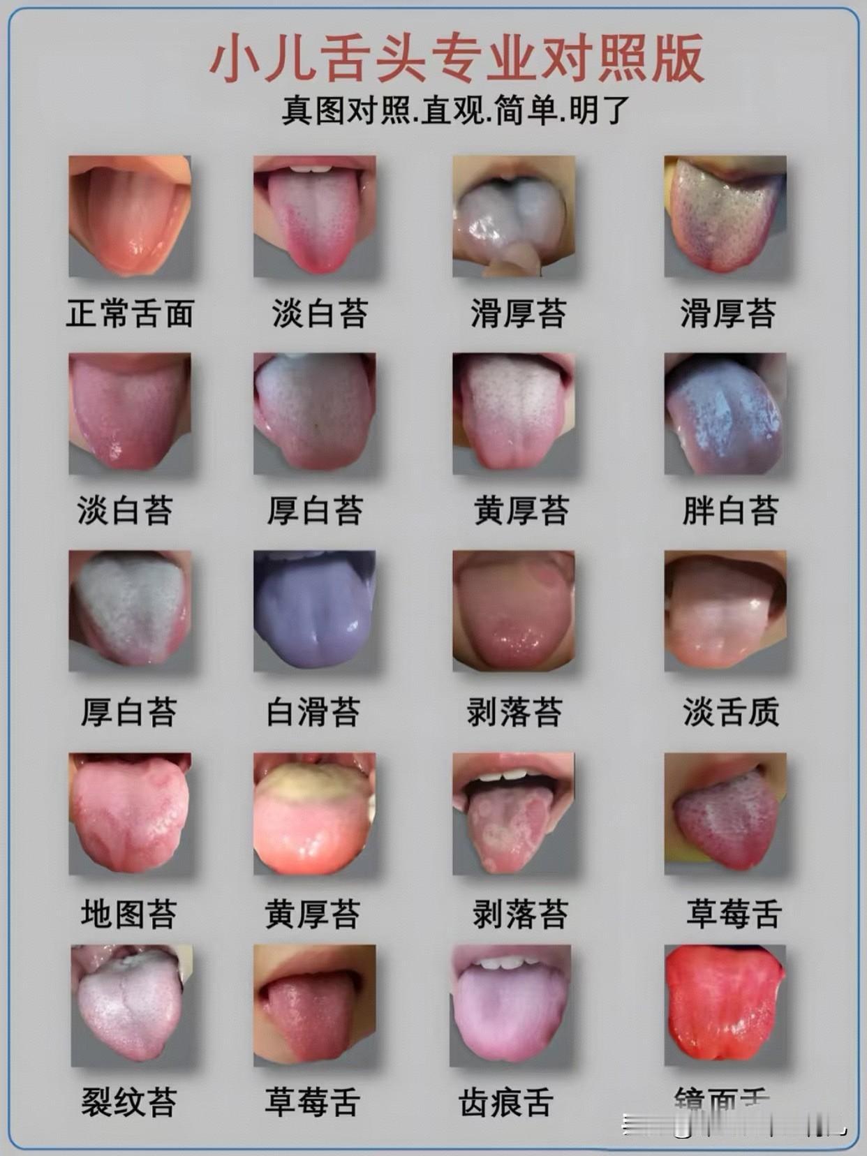 如何给孩子看舌苔真图拍照，按图索骥！