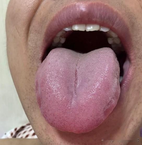 都快奔四的人了，还以为自己是小伙子，天天晚上不节制，总想充电！

这是一个39岁