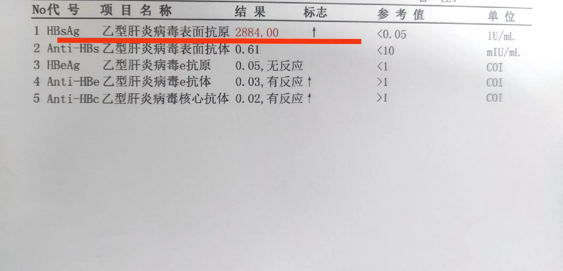 乙肝表面抗原越高，病情就越重吗？判断是否感染乙肝病毒有一项参考指标是乙...