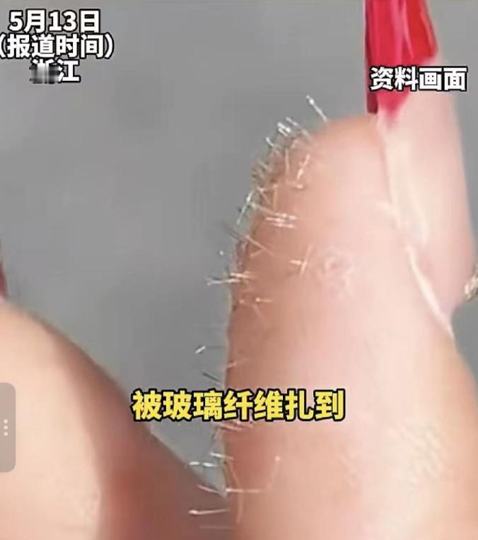 浙江，一女生不小心被玻璃纤维扎满手，又刺又痒看不见，她没去医院、没拿针乱挑，直接