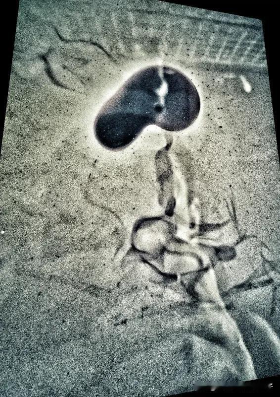 夫妻为娃争吵丈夫血管气炸40cm 夫妻为娃争吵丈夫血管气炸40cm这新闻太吓人了