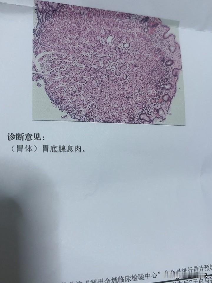 病理结果出来了，担心可好几天，结果跟我想的一样。

说实话，我的胃之前两个多月真