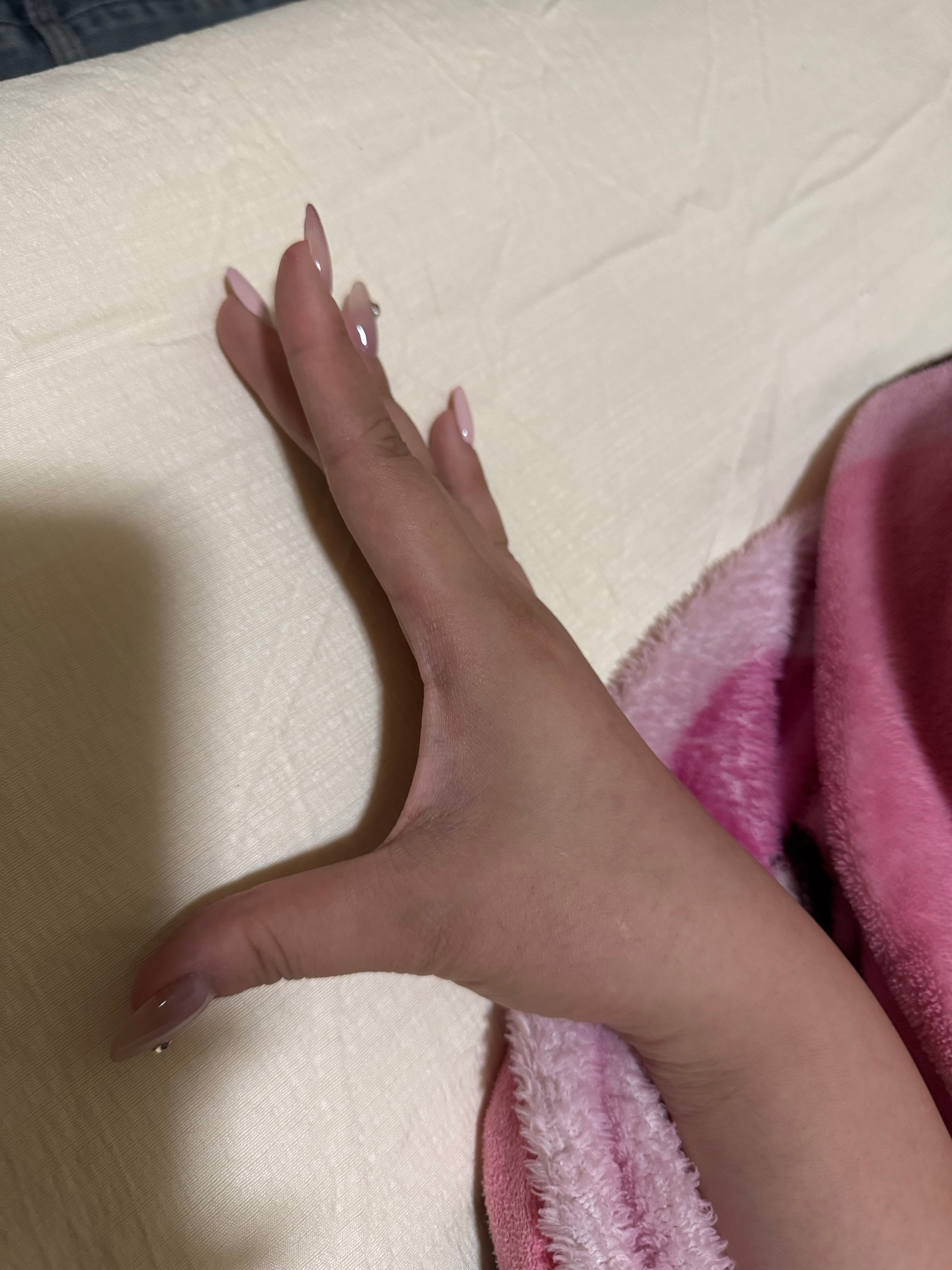 卧槽 我手背已经晒分层了 