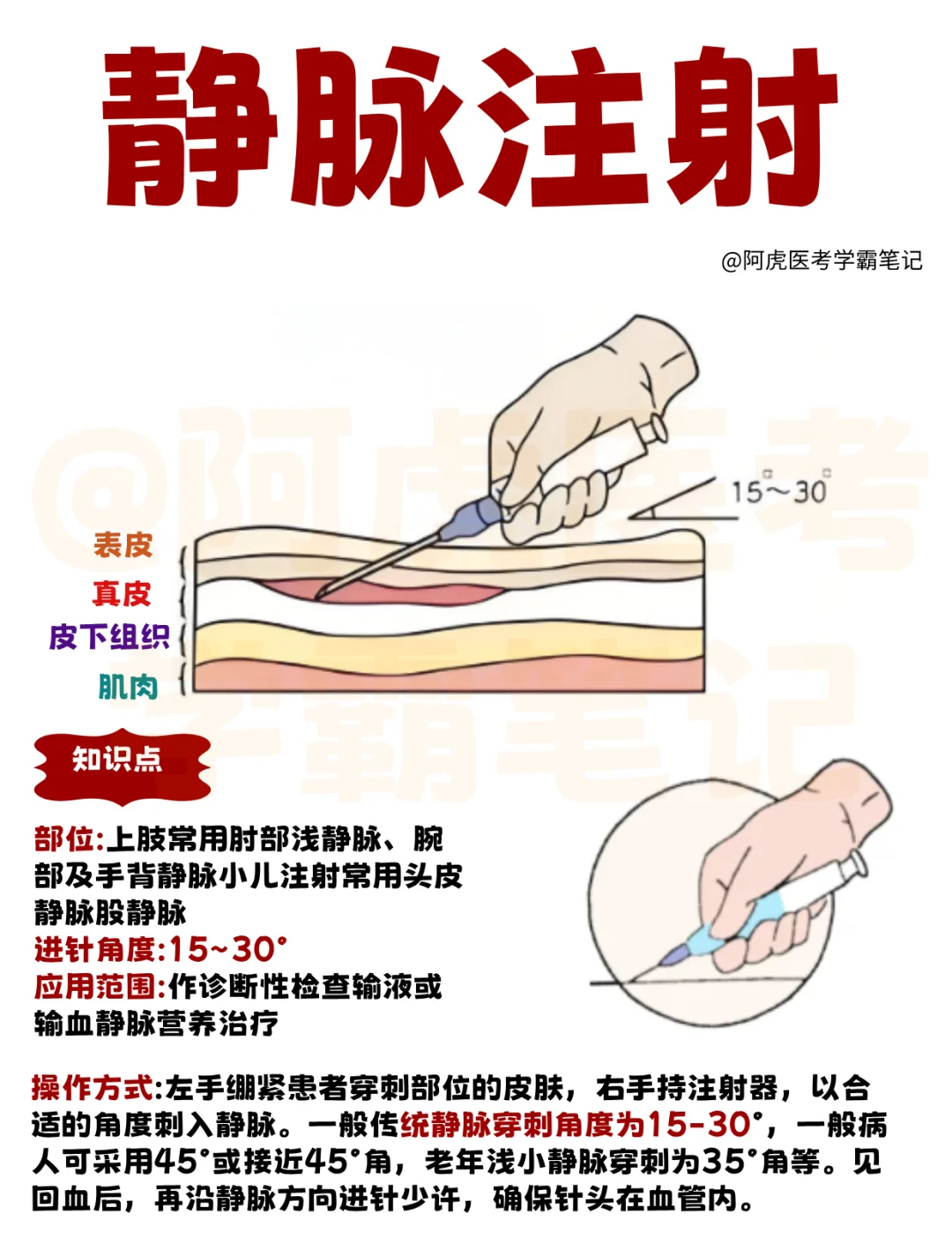 医学生笔记📒：静脉注射👆