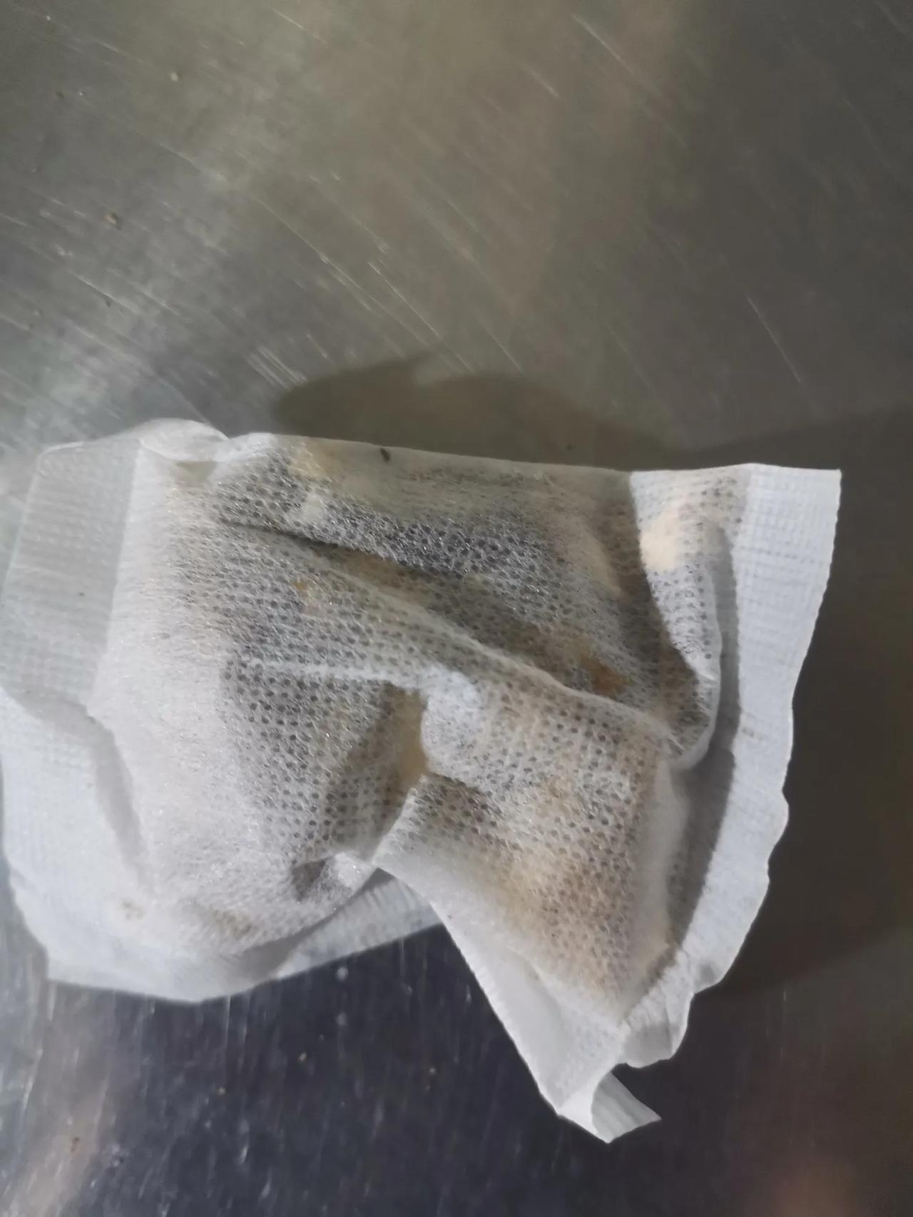 肾病难治，治起来费用非常高，而且一般都治不好。
      恰恰好相反，肾病预防