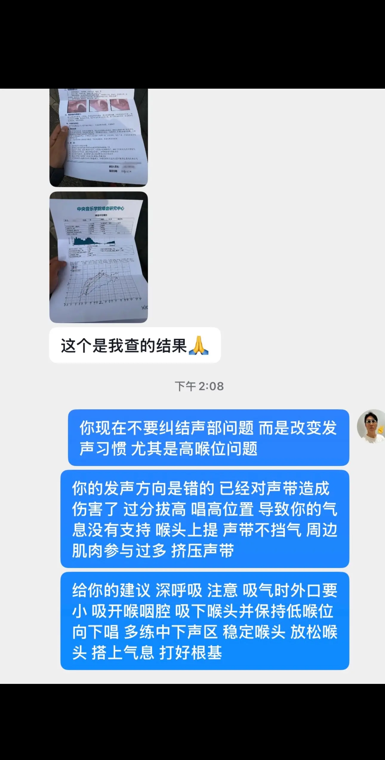 高音都能唱的杠杠杠。愿天下声带皆无恙 你我声带皆健康 高音唱的杠杠杠