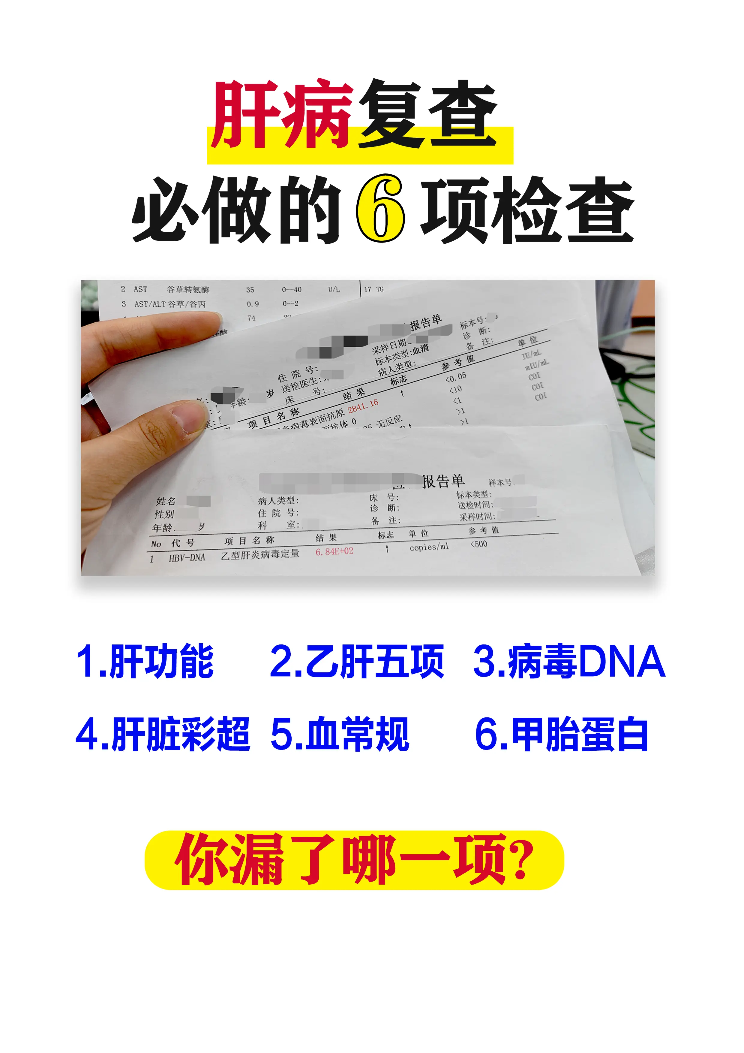 肝病 乙肝 肝硬化 健康科普