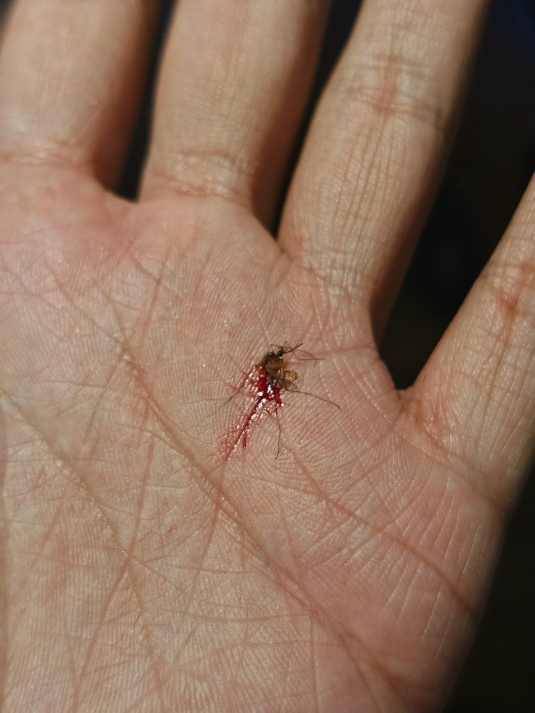 这蚊子，把我咬醒了就跑。过了几个小时挺着个大肚子还没消化完，又跑过来想再补一口。