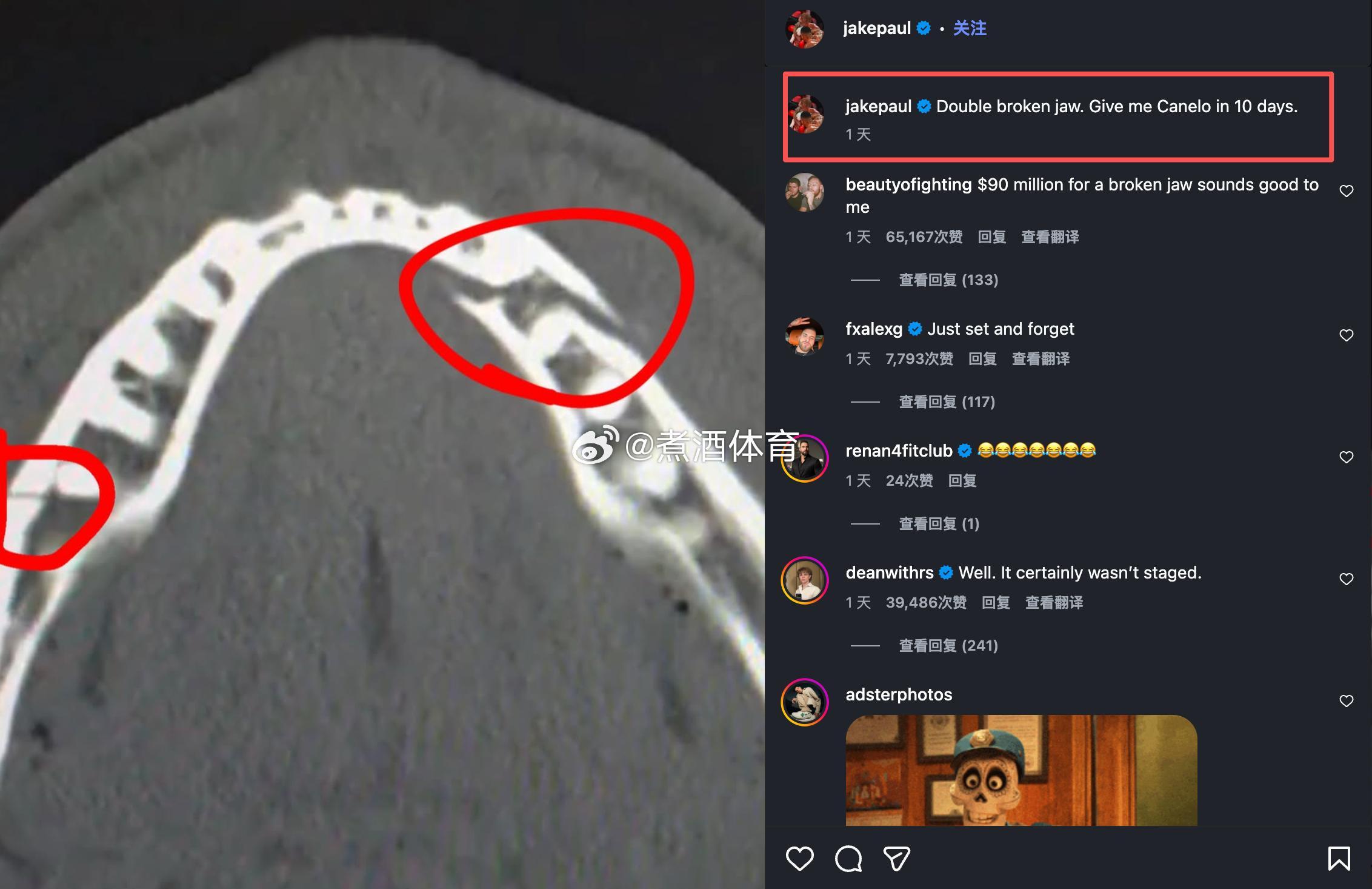 拳坛速递 杰克·保罗Jake Paul 赛后叫阵 卡内罗-阿瓦雷兹Canelo 