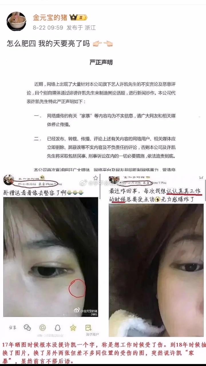 之前爆许凯家暴的女生出来发文:怎么肥四，我的天要亮了吗关于家暴这个事情，当年许凯