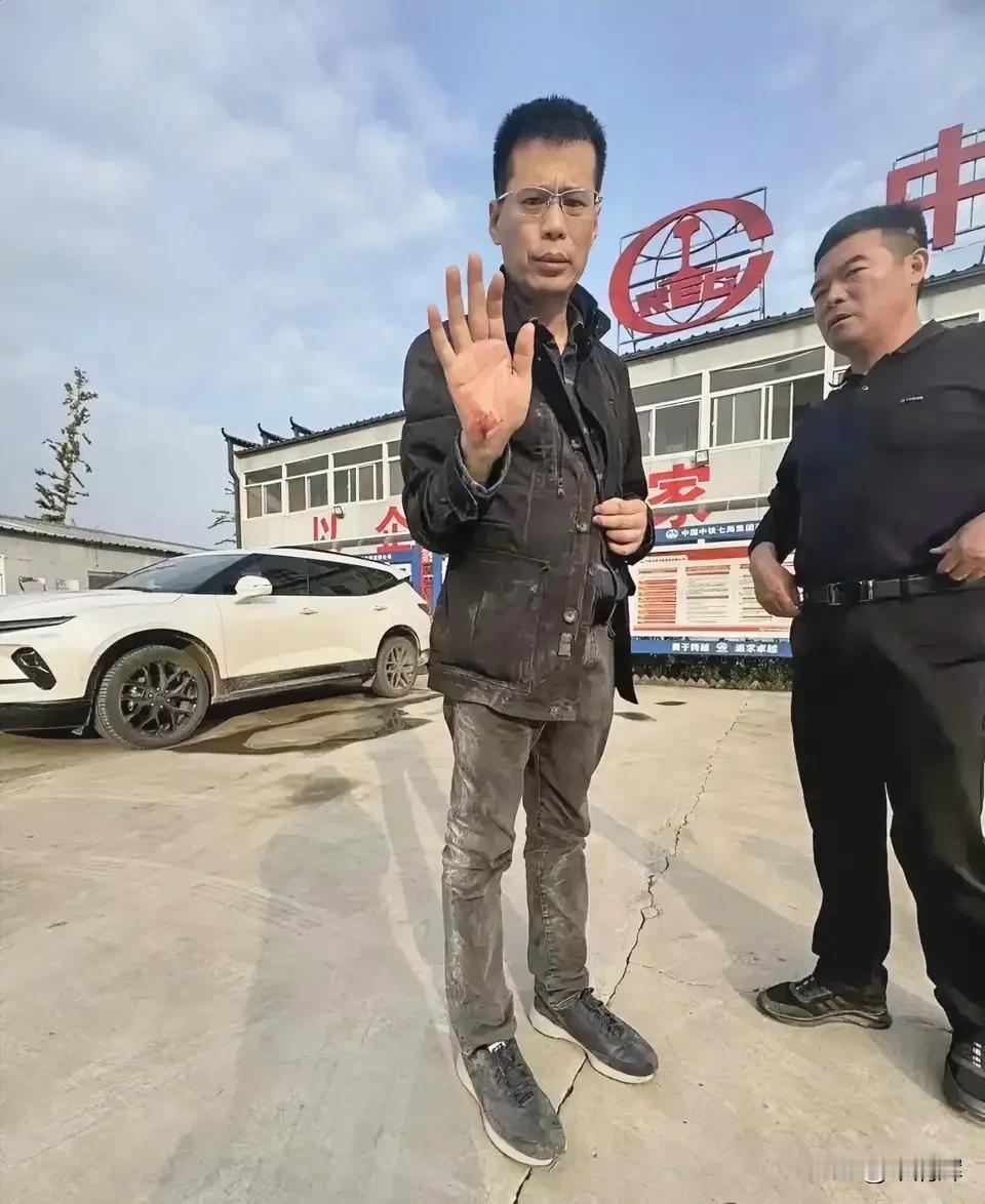 两名调查记者采访时遇袭手机被抢对待“无冕之王”的记者都如此，对待普通老百姓会心慈