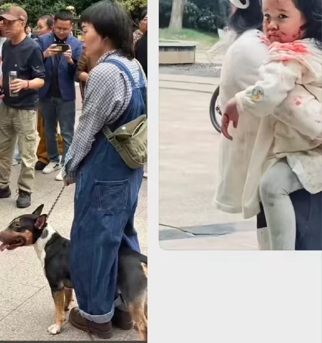 遛狗只牵绳是远远不够的！强烈要求狗狗出门必须戴嘴套。

看照片上小女孩伤的很重，