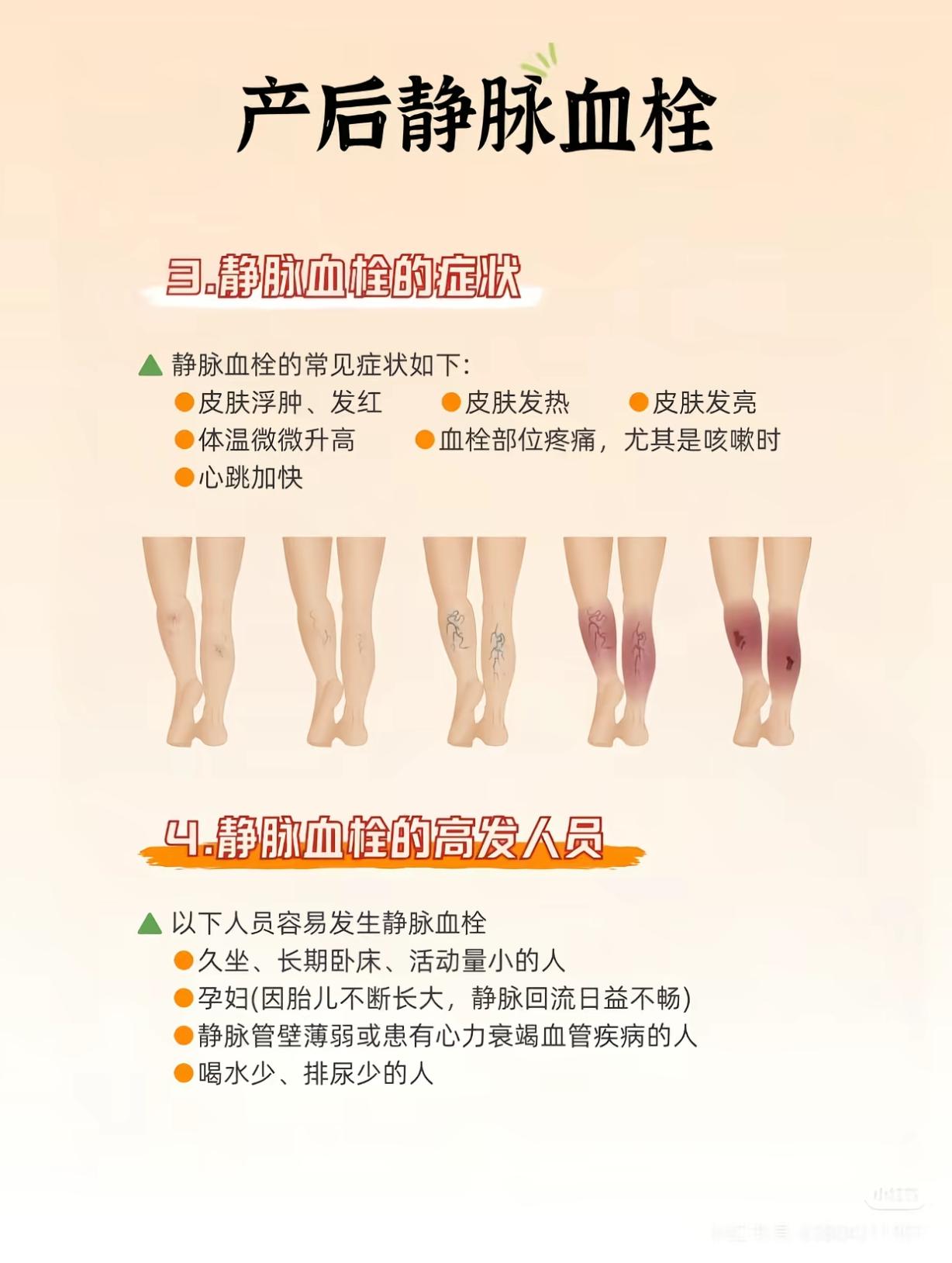 产后预防血栓最全实用方法（顺产、剖腹产都适用）
 
产后是静脉血栓高发期，怀孕激