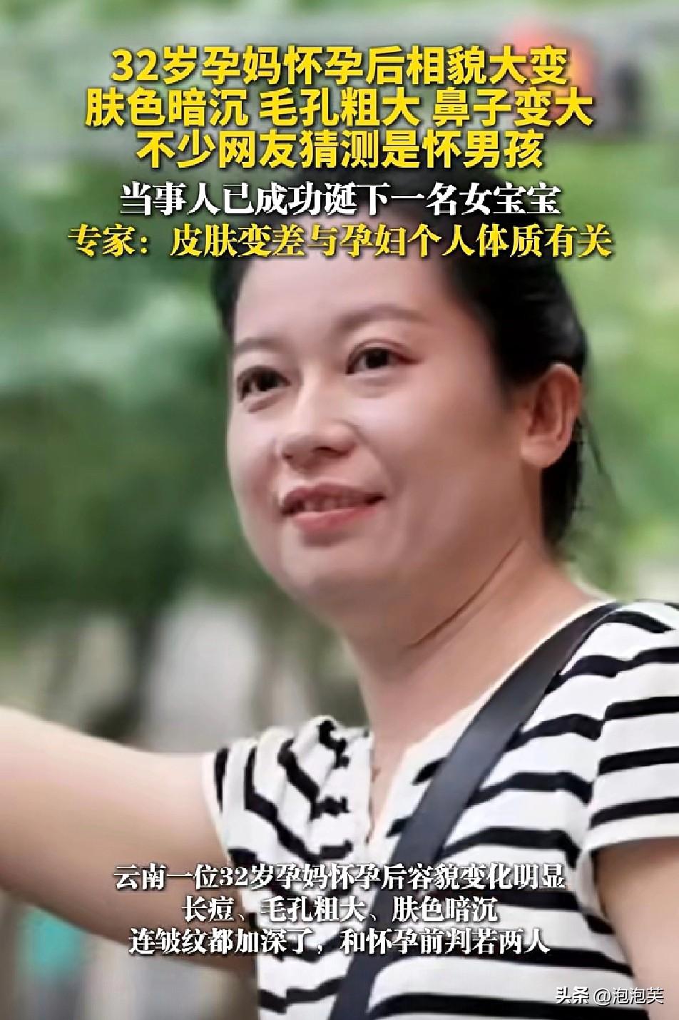 云南一位32岁孕妈

孕期皮肤暗沉、毛孔粗大鼻子变大

网友纷纷猜测怀男孩

结