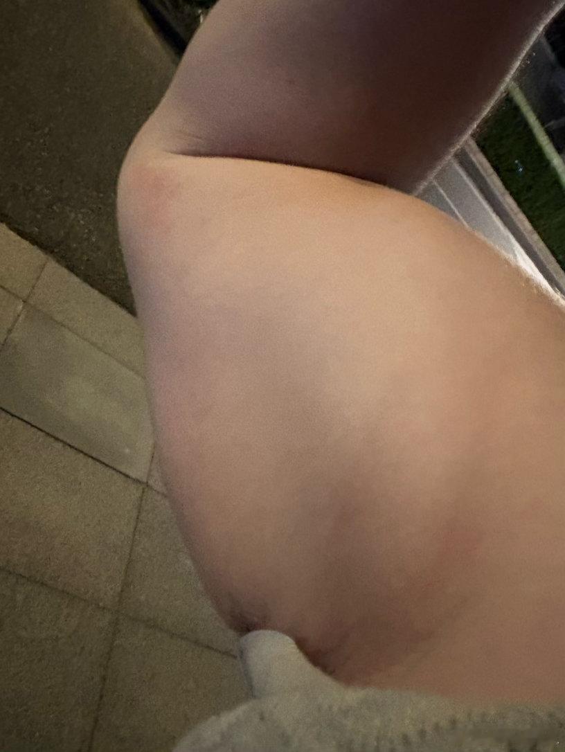提倡文明游泳噢，禁止抓咬摸……光是两条胳膊就7处伤，被抓的浑身是伤，从没想到泳裤