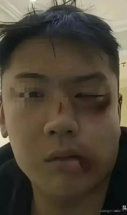 男子因为不孝顺父母，年前老舅特意上门把这个外甥好好修理了一下。
外甥不服气又不敢