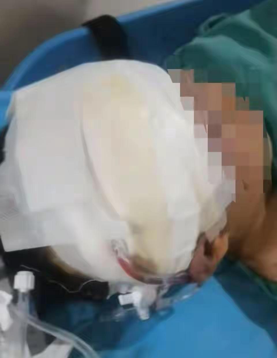 江西九江，13岁的男孩因为叛逆，在学校经常惹是生非，父母实在没有办法，就化了3.