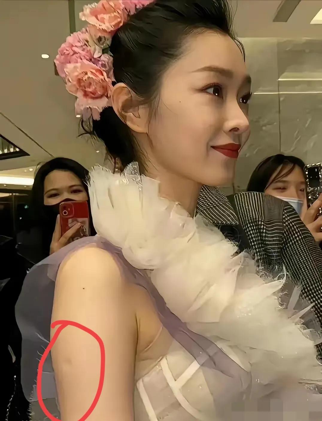 胳膊上这个窝窝，是不是每个人都有呢？