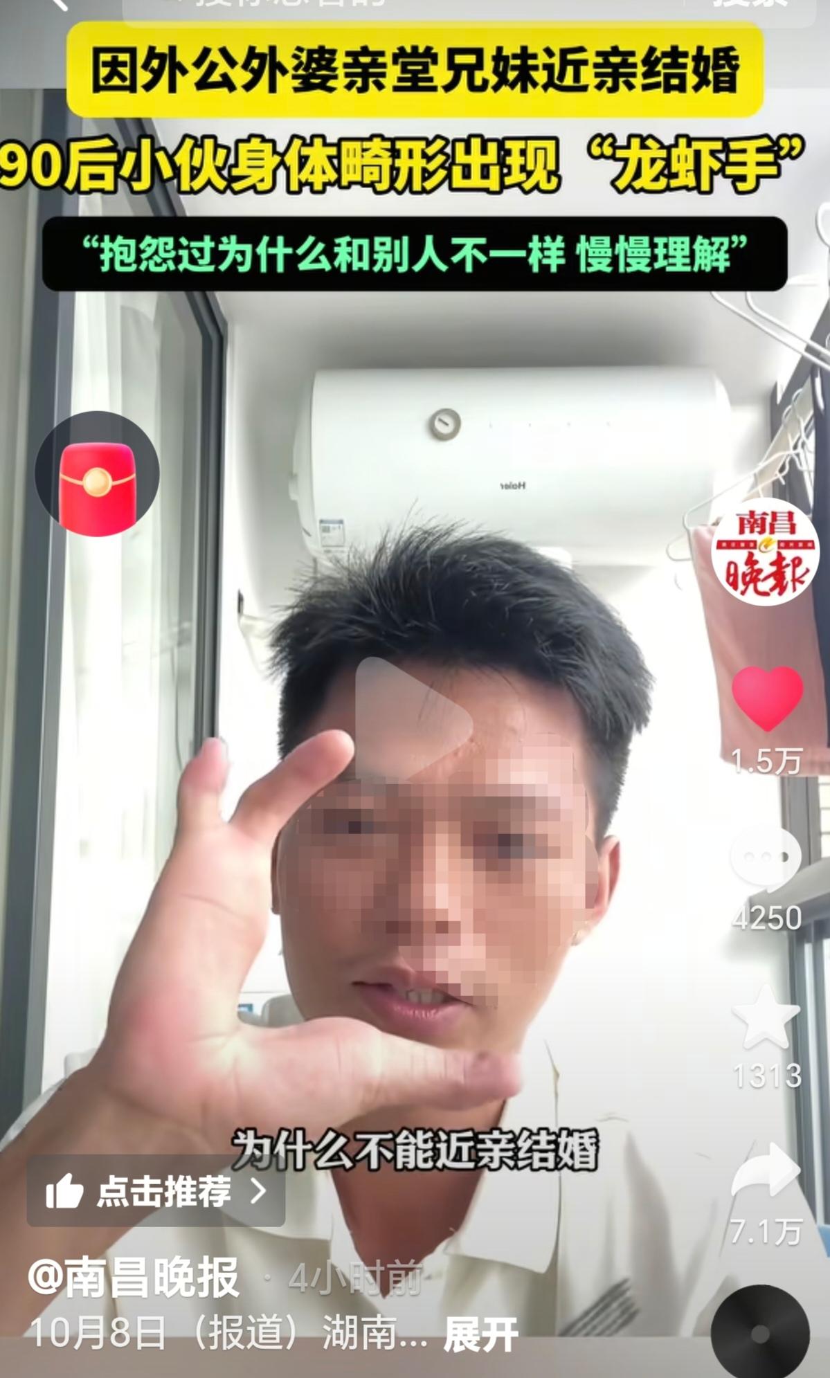 惊呆了！90后小伙身体畸形出现异常，只因自己的外公外婆是近亲结婚。小伙说他的外公