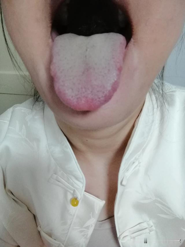 说了多少遍了，有问题不要拖，还是不当回事[发怒][发怒][发怒]
你看这舌头都糟