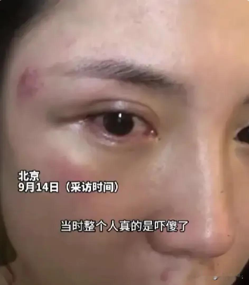 太暖了！北京突降冰雹，路边女子被砸得不知所措，两位陌生大哥毫不犹豫冲了上去……