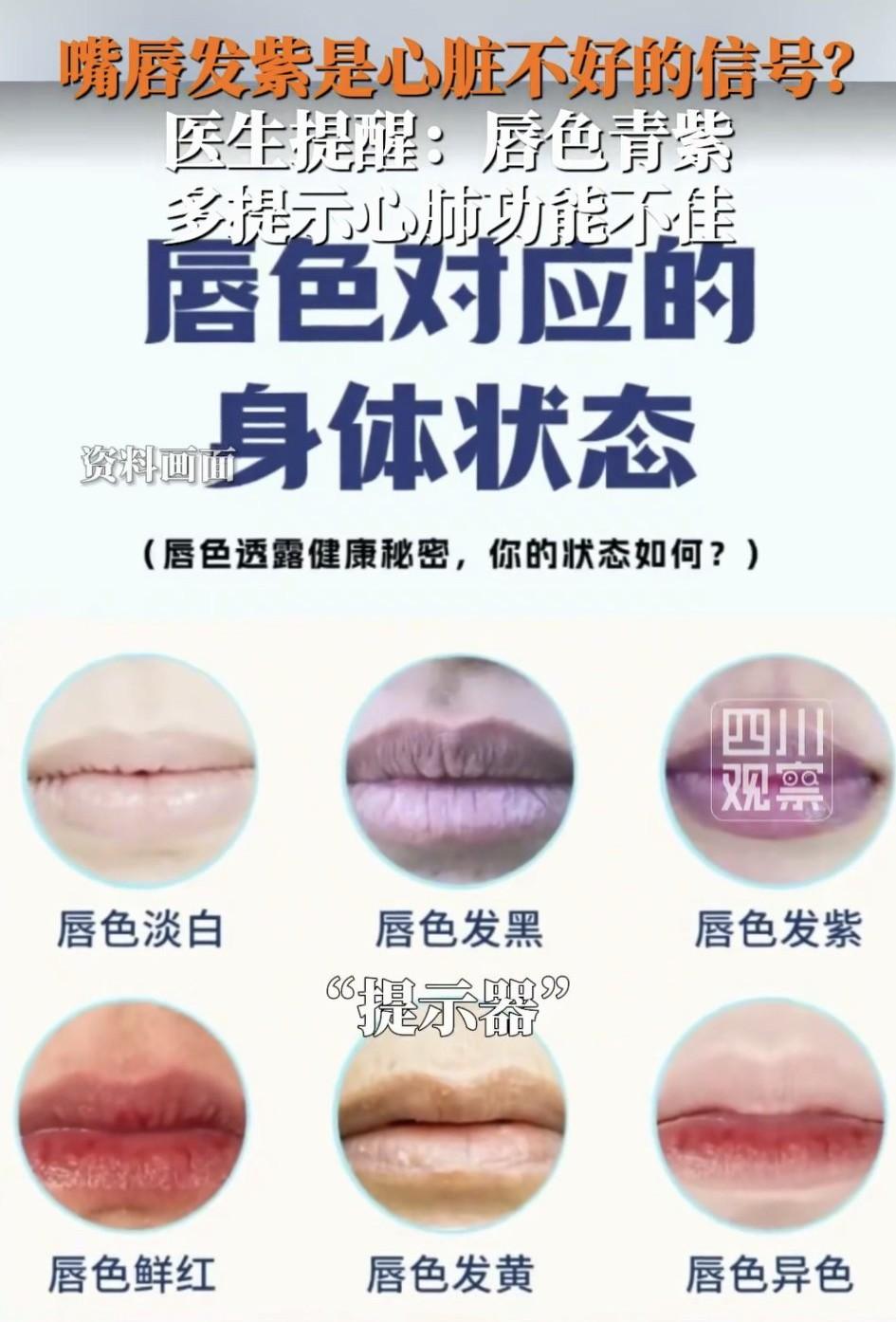 原来我们嘴唇的颜色是身体的晴雨表，当我们的嘴唇颜色变得青紫的时候，对应的是我们身