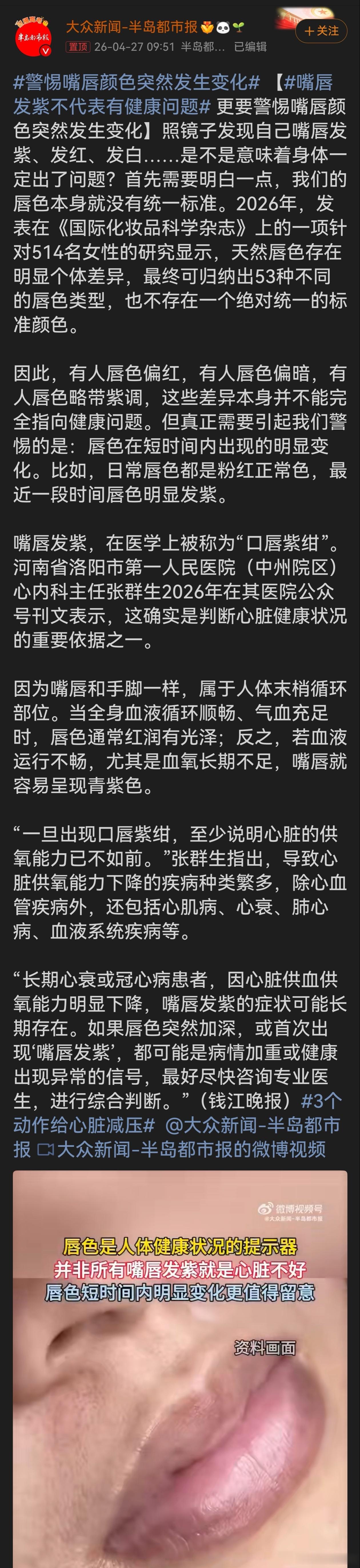 嘴唇发紫不代表有健康问题这段科普很实用。它提醒我们唇色个体差异正常，不必因固有唇