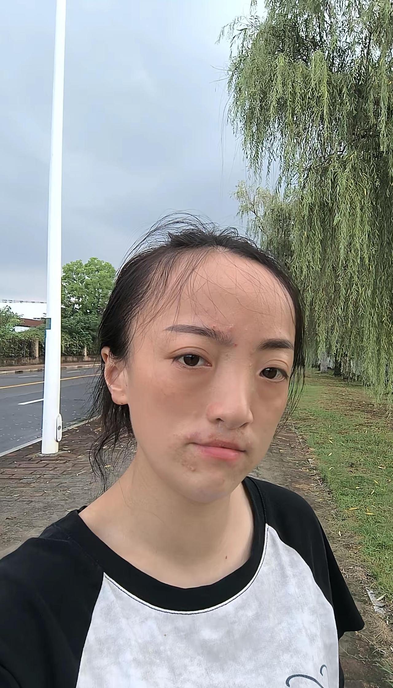 生于1988，虚岁39，命比黄莲还苦，出生就面带缺陷，终究是一生的遗憾，除了父母