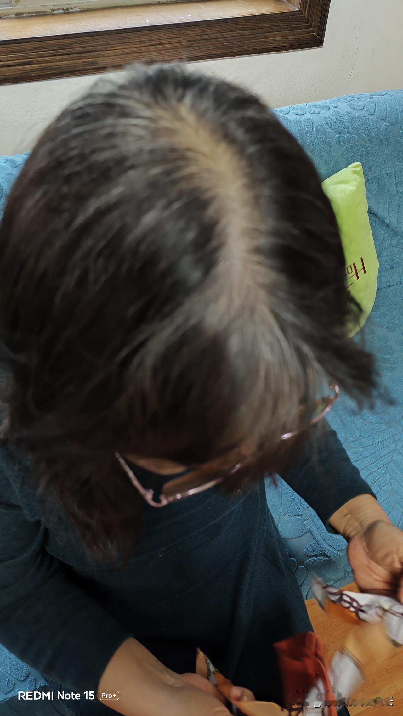 女人，只可远观，不可俯瞰。远看长发飘飘，俯瞰贫瘠一片。
头顶的脱发是洗发香波造成